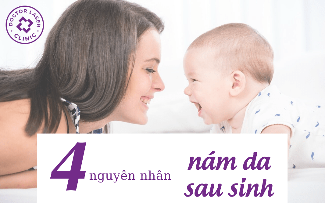 nám da sau sinh