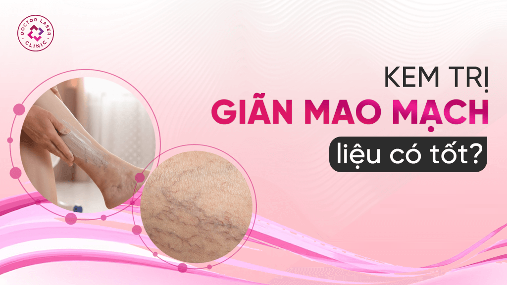 Kem trị giãn mao mạch liệu có tốt?