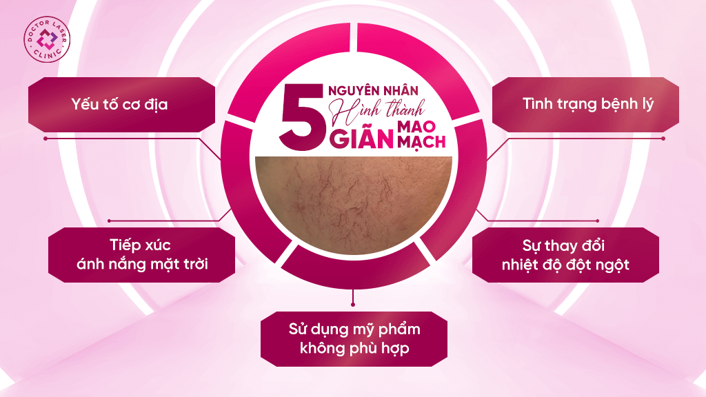 Nguyên nhân da bị giãn mao mạch