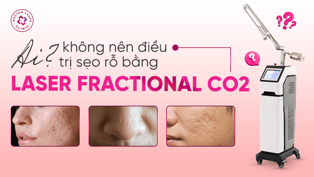 Ai không nên điều trị sẹo rỗ bằng Laser CO2 Fractional
