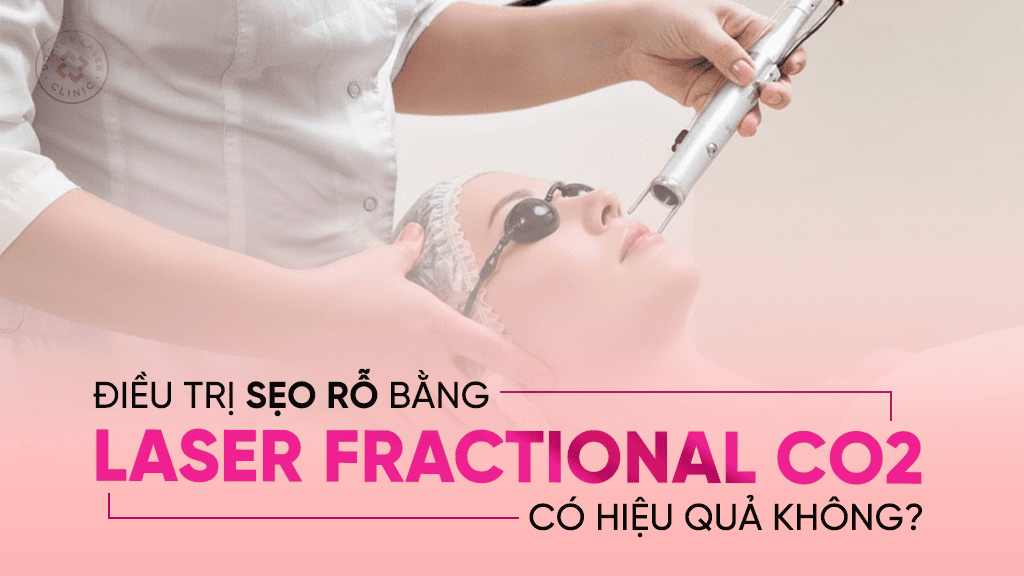 Điều trị sẹo rỗ bằng laser CO2 Fractional có hiệu quả không
