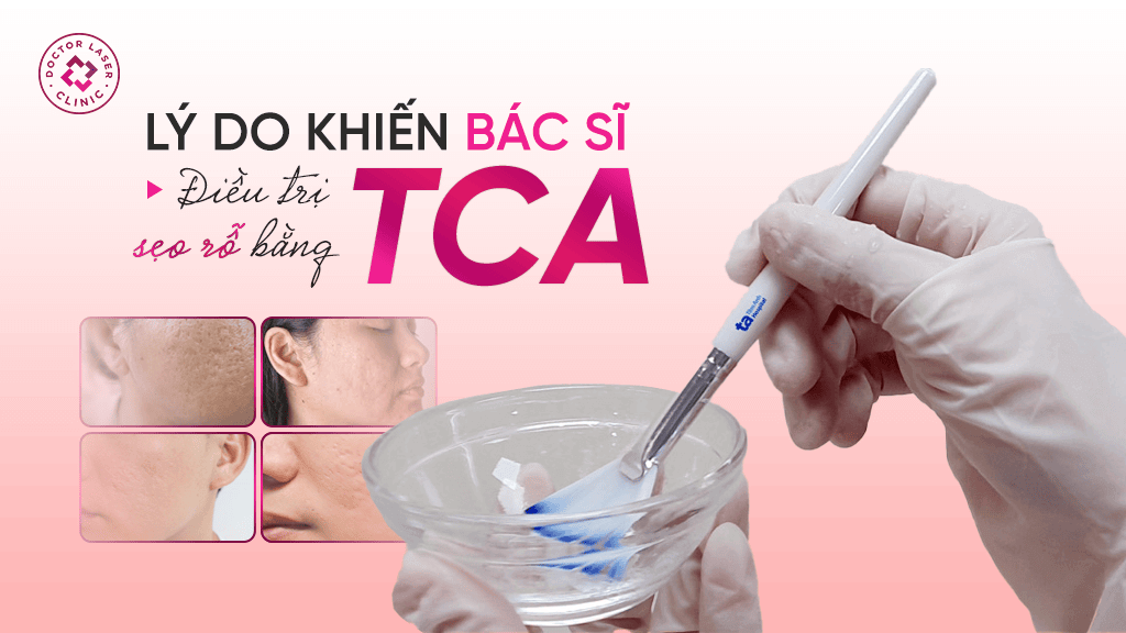 Lý do bác sĩ điều trị sẹo rỗ bằng TCA