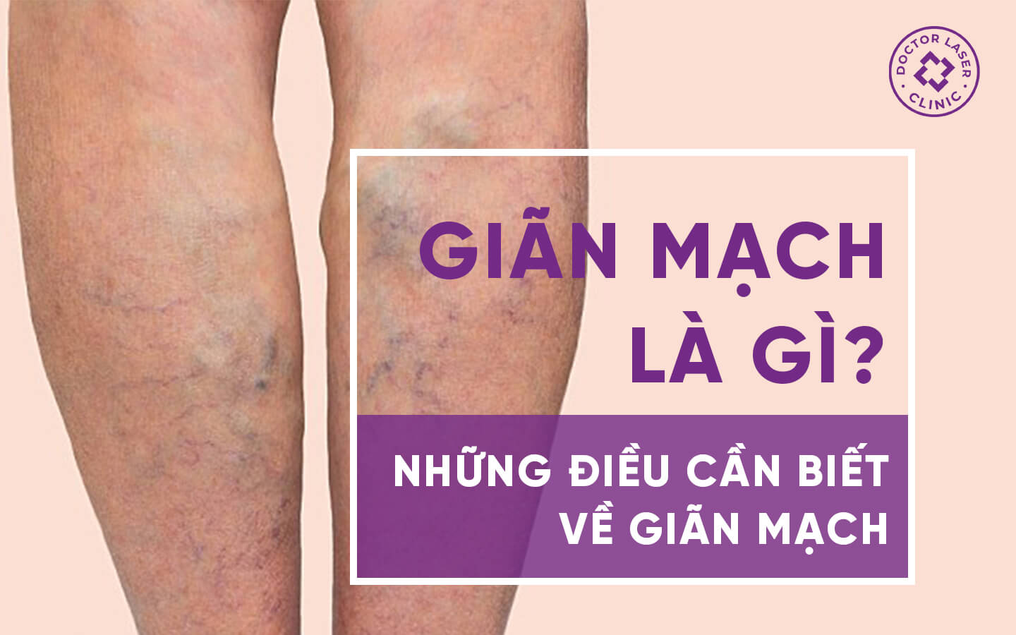 Giãn Sẹo Là Gì? Hướng Dẫn Chi Tiết và Phương Pháp Điều Trị Hiệu Quả