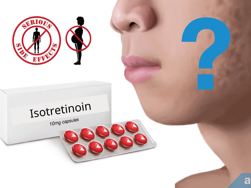 Isotretinoin có khả năng trị mụn vậy có thể điều trị da sẹo rỗ không?