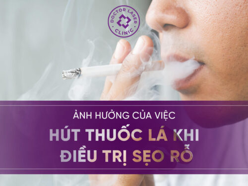 ẢNH HƯỞNG CỦA VIỆC HÚT THUỐC LÁ KHI ĐIỀU TRỊ SẸO RỖ