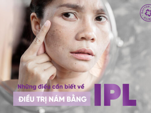 NHỮNG ĐIỀU CẦN BIẾT VỀ ĐIỀU TRỊ NÁM BẰNG IPL