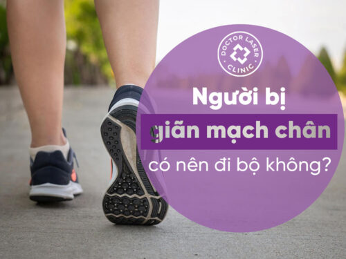 NGƯỜI BỊ GIÃN TĨNH MẠCH CH N CÓ NÊN ĐI BỘ KHÔNG?