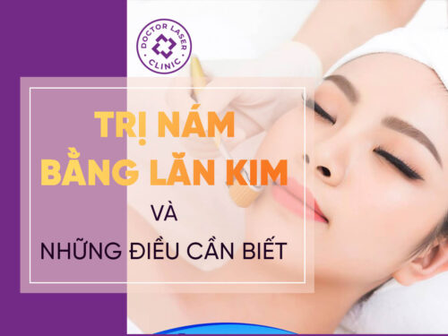NHỮNG ĐIỀU CẦN BIẾT VỀ ĐIỀU TRỊ NÁM BẰNG LĂN KIM