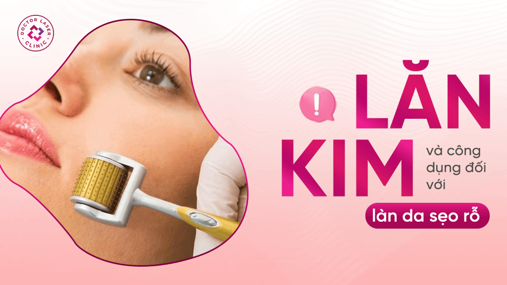 Hiệu quả của lăn kim trị sẹo rỗ lâu năm