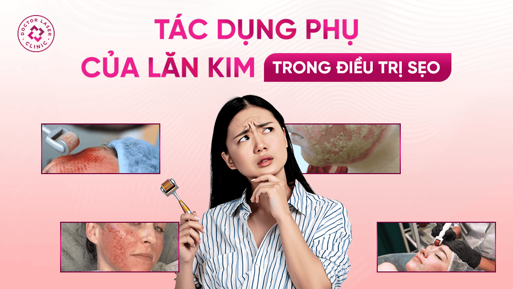 Tác dụng phụ của lăn kim trong điều trị sẹo