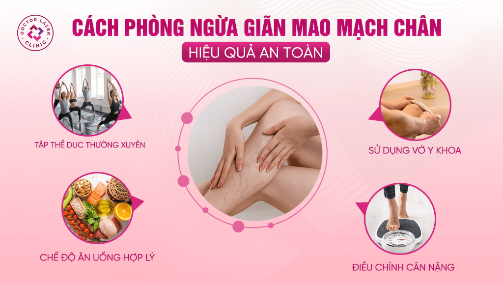 Một số cách phòng giãn mao mạch ở chân hiệu quả