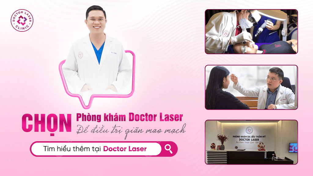 Cơ sở điều trị giãn mao mạch uy tín – Doctor Laser