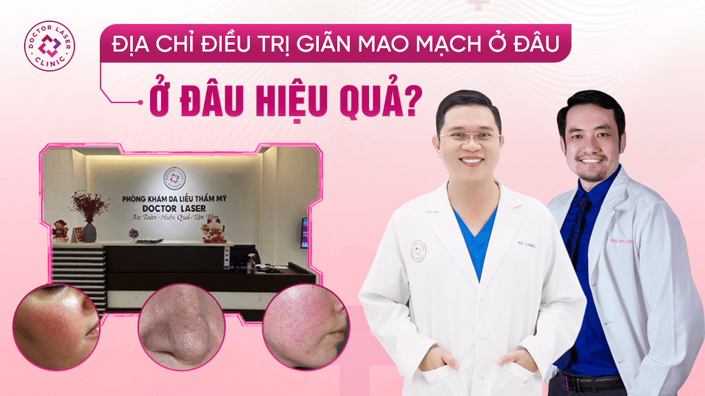 Địa chỉ điều trị giãn mao mạch ở đâu uy tín hiệu quả