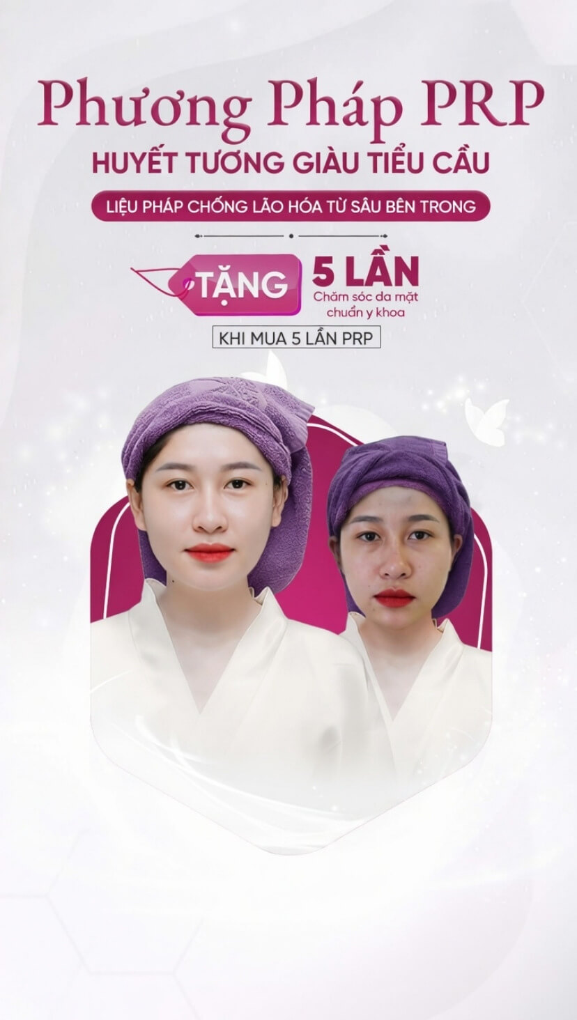 banner dịch vụ prp huyết tương giàu tiểu cầu