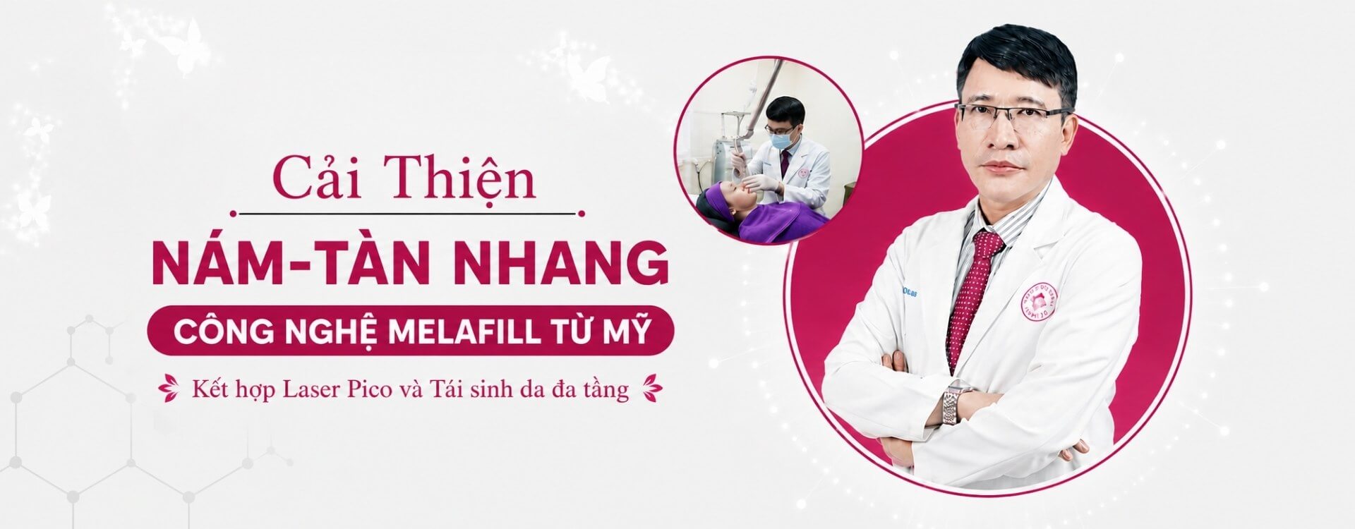 banner điều trị nám tàn nhang desktop