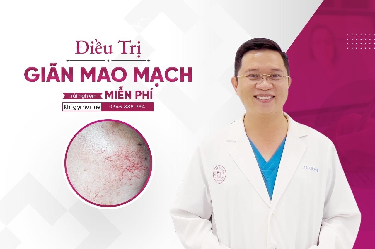 điều trị giãn mao mạch doctor laser