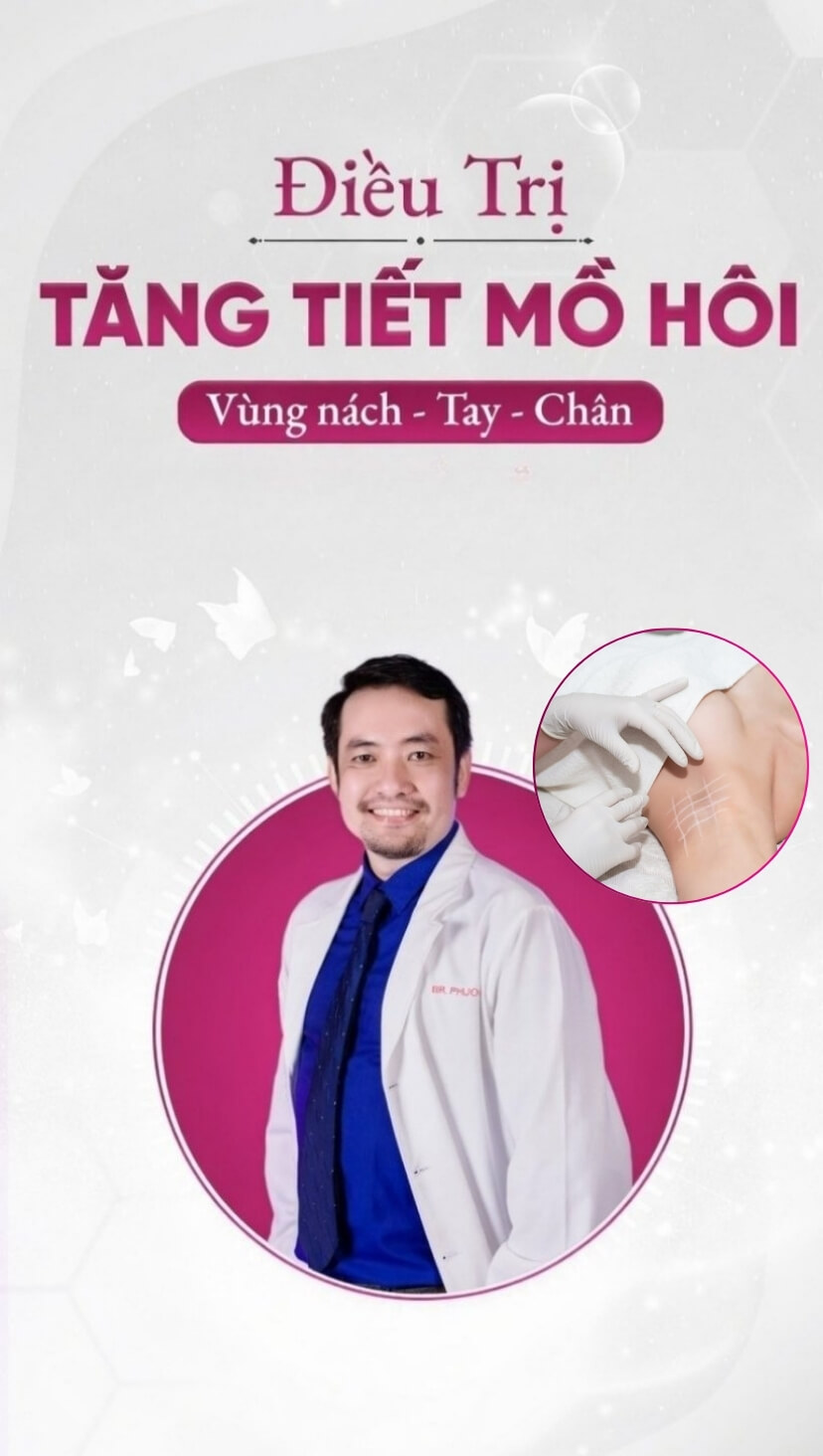 banner điều trị tăng tiết mồ hôi mobile