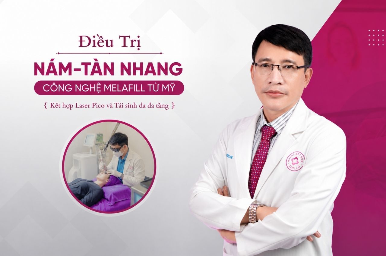 dịch vụ điều trị nám tàn nhang