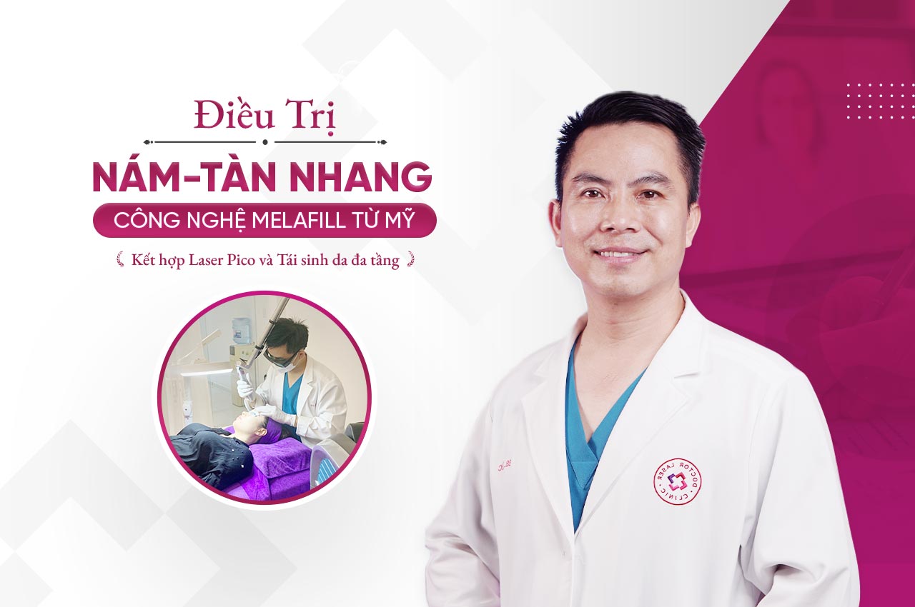 điều trị nám tàn nhang doctor laser