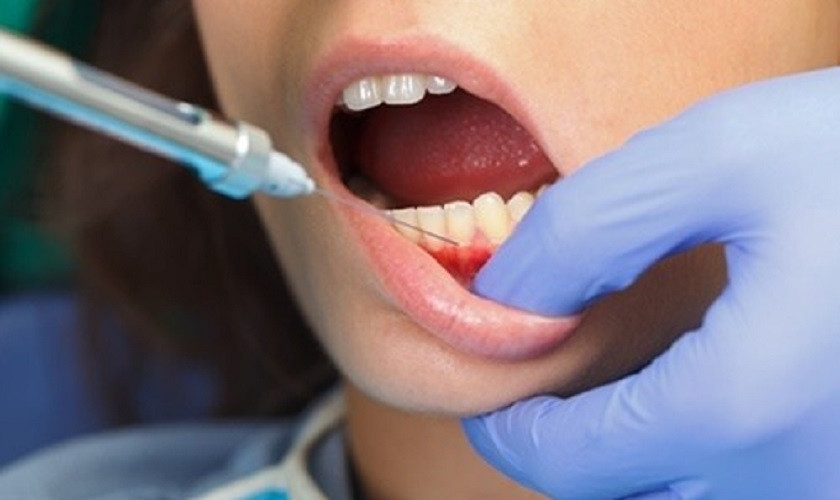 nghiên cứu tiêm botox trị nghiến răng