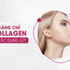 Căng chỉ collagen có tác dụng gì?