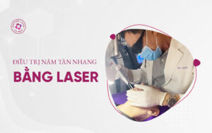 điều trị nám tàn nhang bằng laser