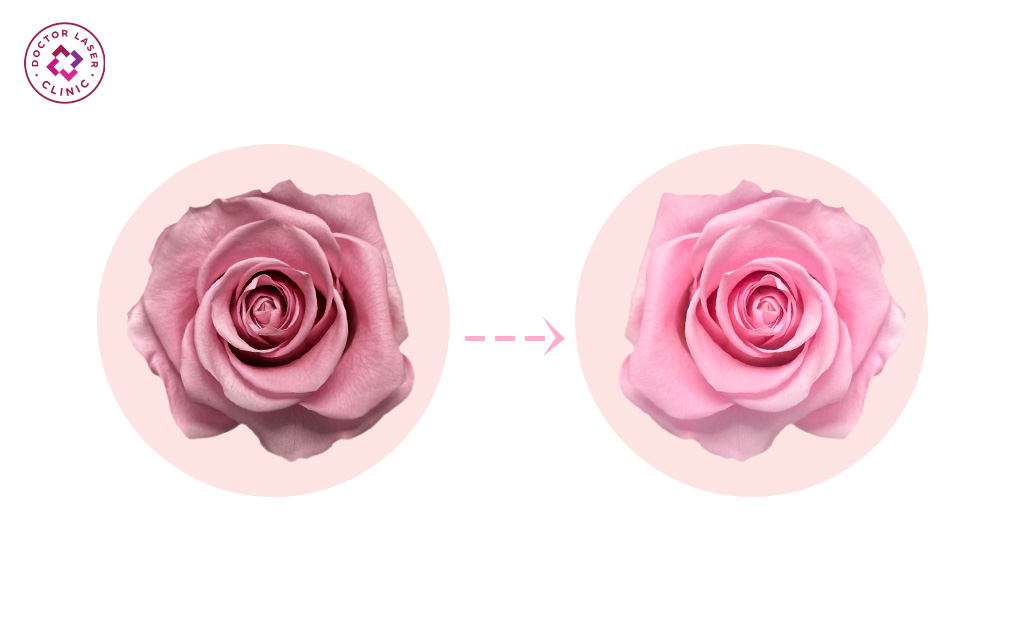 cách làm hồng nhũ hoa cấp tốc hiệu quả