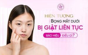 Bọng mắt dưới bị giật liên tục có nguy hiểm không?