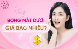 Lấy bọng mắt dưới giá bao nhiêu?