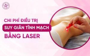 Chi phí điều trị tĩnh mạch bằng laser