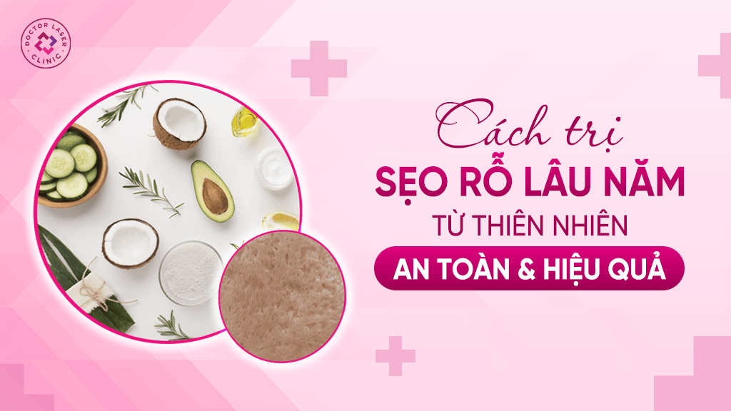 Cách trị sẹo rỗ lâu năm từ thiên nhiên an toàn hiệu quả