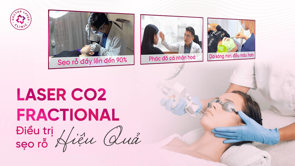 Điều trị sẹo rỗ tại Doctor Laser