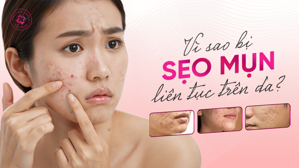 Sự tiến triển của sẹo rỗ