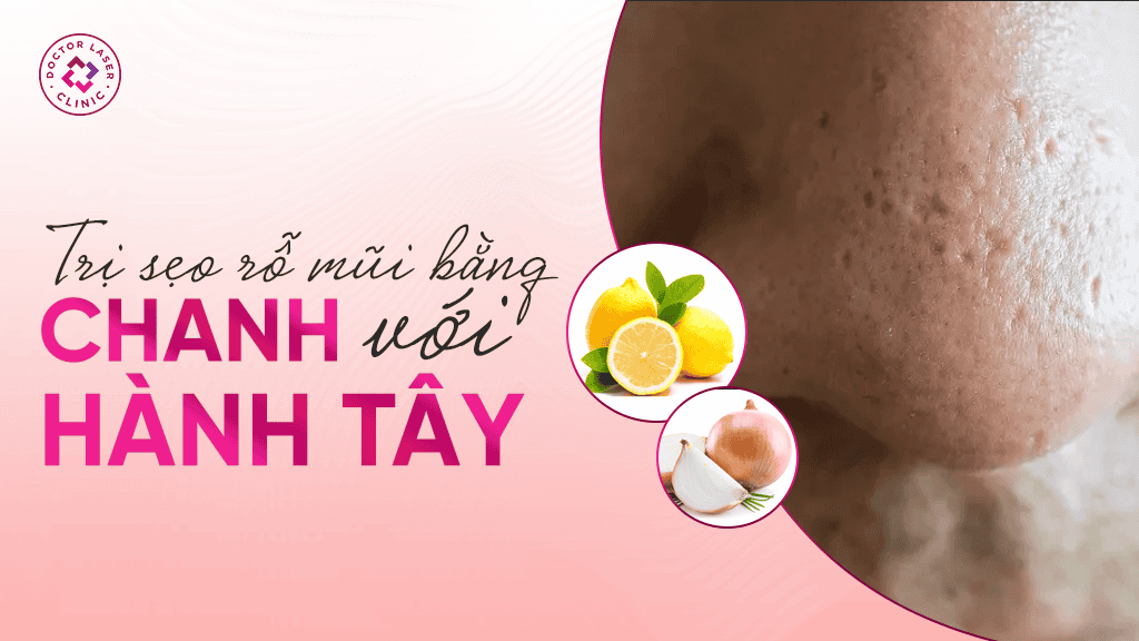 Trị sẹo rỗ mũi bằng chanh với hành tây