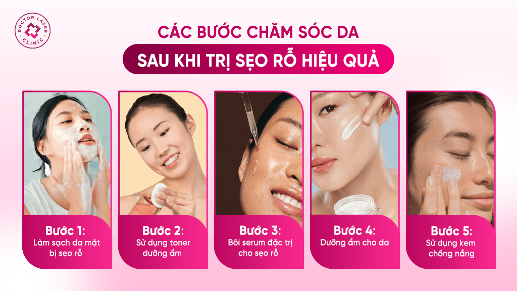 Các bước chăm sóc da sau điều trị sẹo rỗ hiệu quả