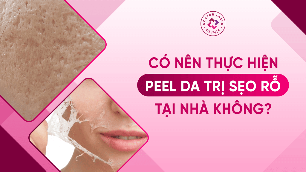 Có nên thực hiện peel da tại nhà không