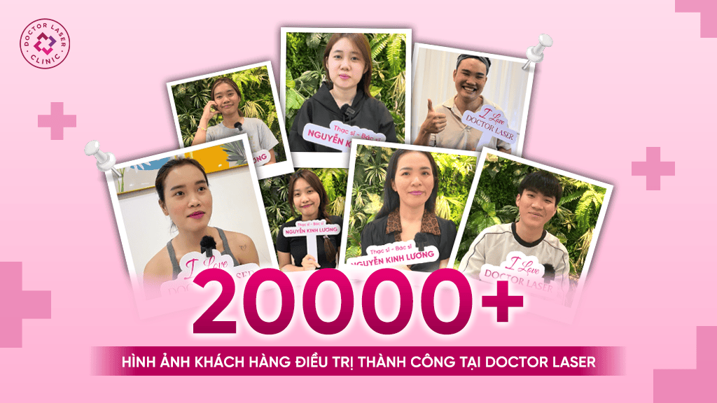 Hình ảnh khách hàng điều trị thành công tại Doctor Laser