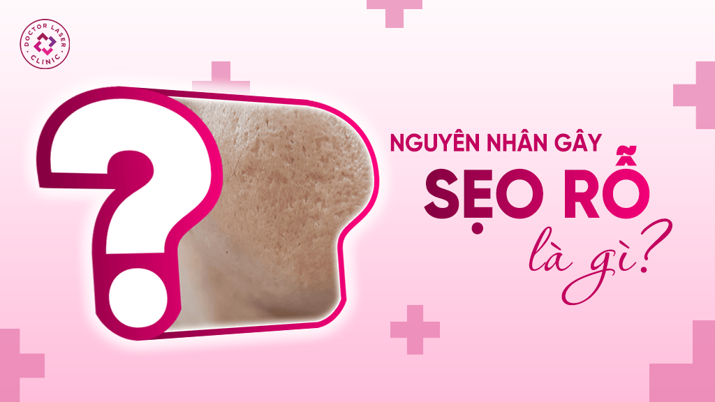 Nguyên nhân gây sẹo rỗ là gì