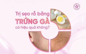 Trị sẹo rỗ bằng trứng gà có hiệu quả không?