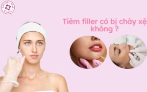 Sau khi tiêm filler có bị chạy xệ không?