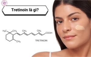 Tretinoin trị sẹo rỗ