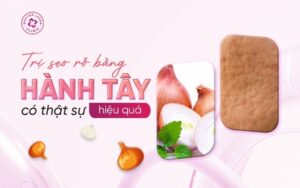 Trị sẹo bằng hành tây có hiệu quả không?