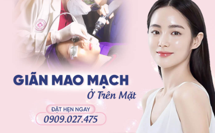Điều trị giãn mao mạch bằng Laser.