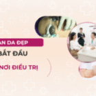 Giãn Mao Mạch:  Điều Trị Bằng Laser – Làm Sao Chọn Spa An Toàn?