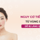 GIÃN MAO MẠCH VÙNG CỔ NGỰC: ÍT GẶP NHƯNG DỄ BỊ BỎ QUA