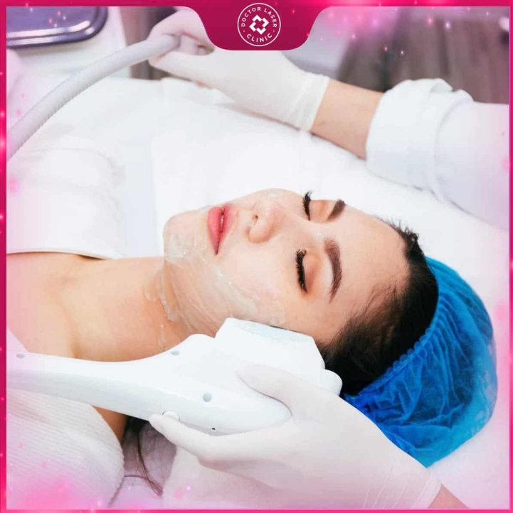 Công nghệ điều trị giãn mao mạch tại Doctor Laser.