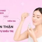 PHÂN BIỆT GIÃN MAO MẠCH VÀ ĐỎ DA DO VIÊM: ĐIỀU TRỊ ĐÚNG – DA KHỎE LẠI