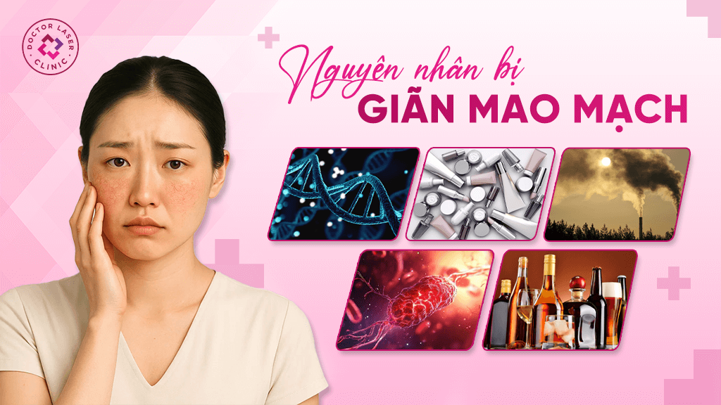 Nguyên nhân thường gặp bị giãn mao mạch
