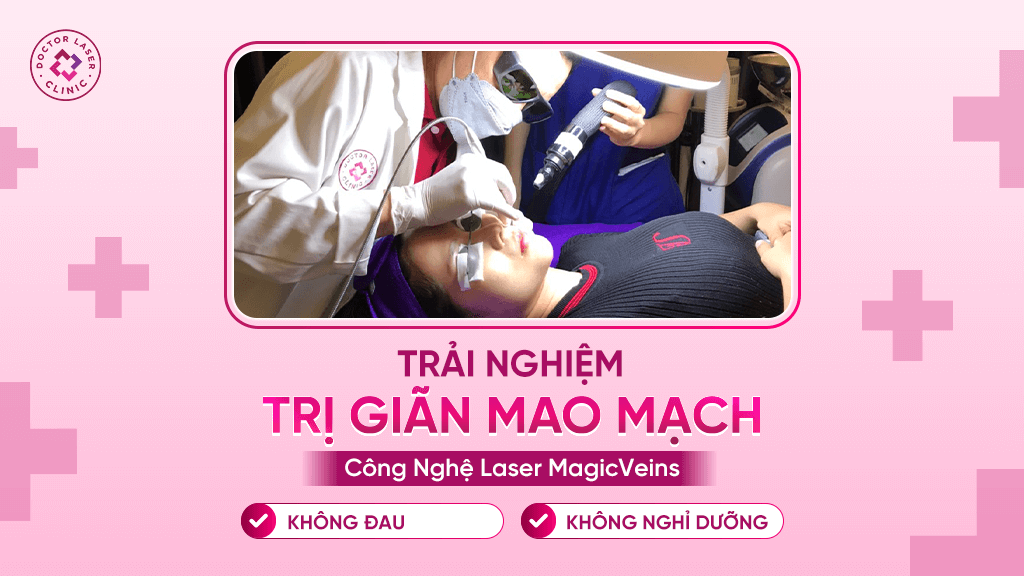 Phương pháp điều trị giãn mao mạch hiện nay tại Doctor Laser