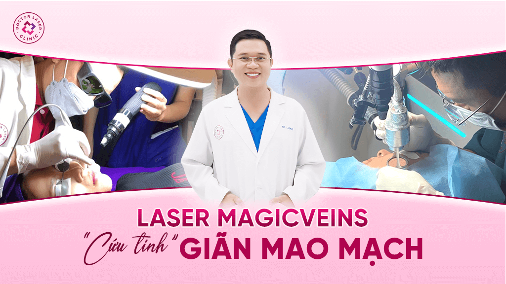 Laser magicveins cứu tinh giãn mao mạch